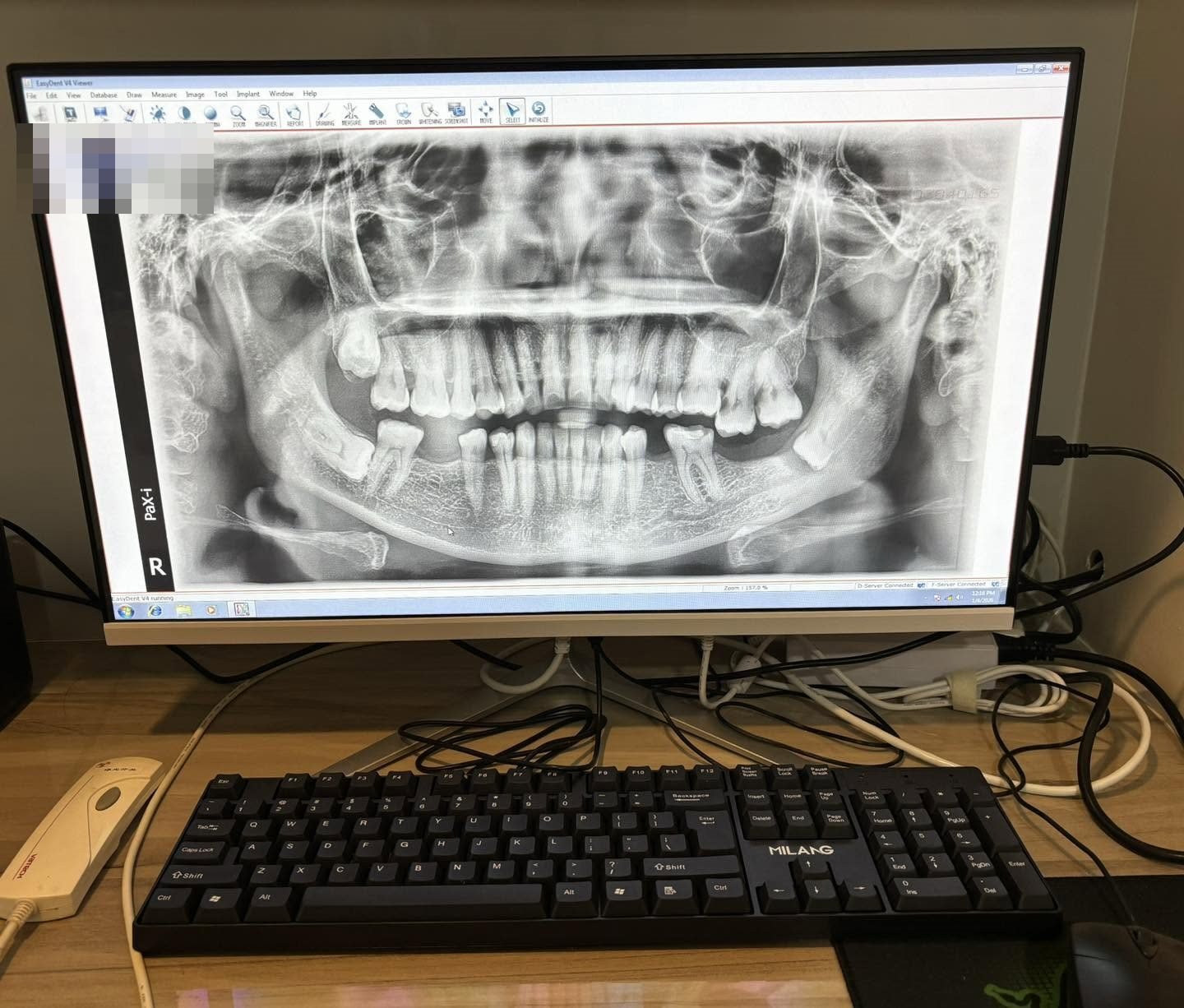 A panoramic dental X-ray on the clinic computer screen